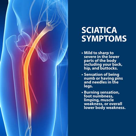 I've read a few medical diagnoses on sciatica, and also spiritual meanings. . Spiritual meaning of sciatic nerve pain